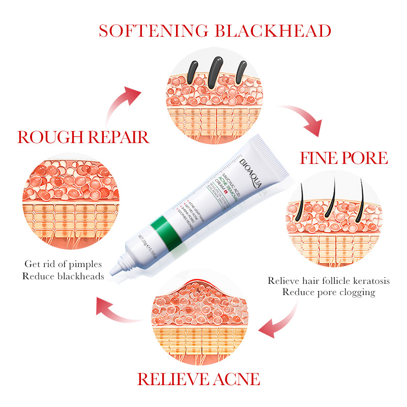 1/2/3 sztuk BIOAQUA kwas salic – Salicylic Acid Blackhead Remover recenzja i cena