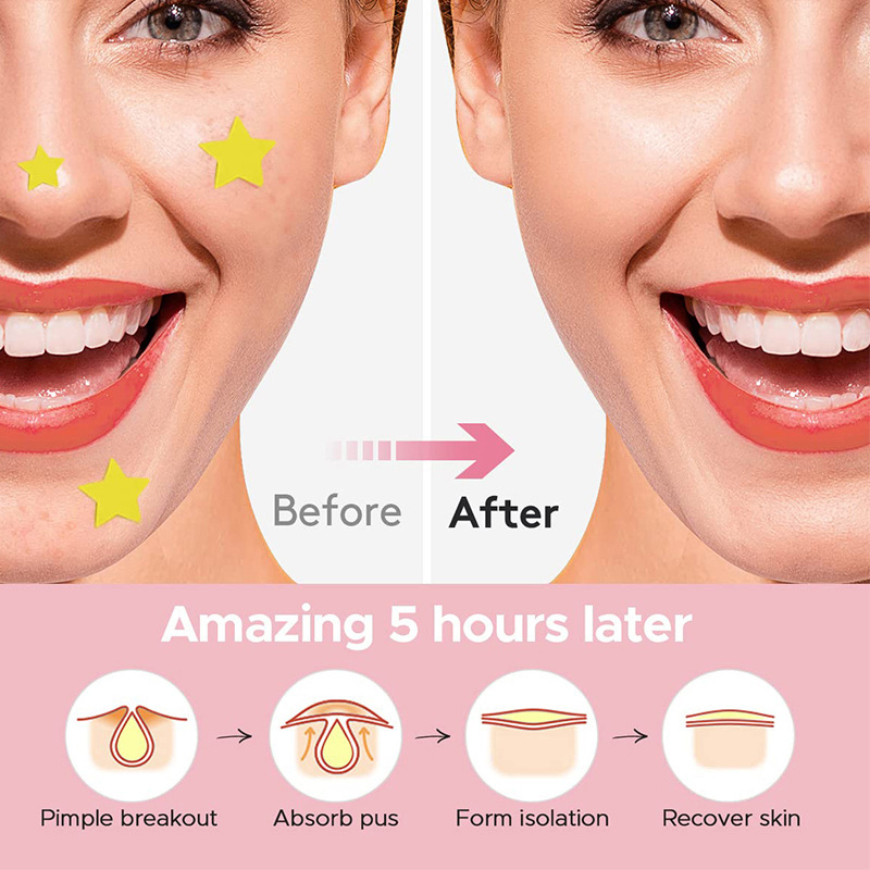 600 sztuk/zestaw Plasterki na  – Skincare recenzja i cena
