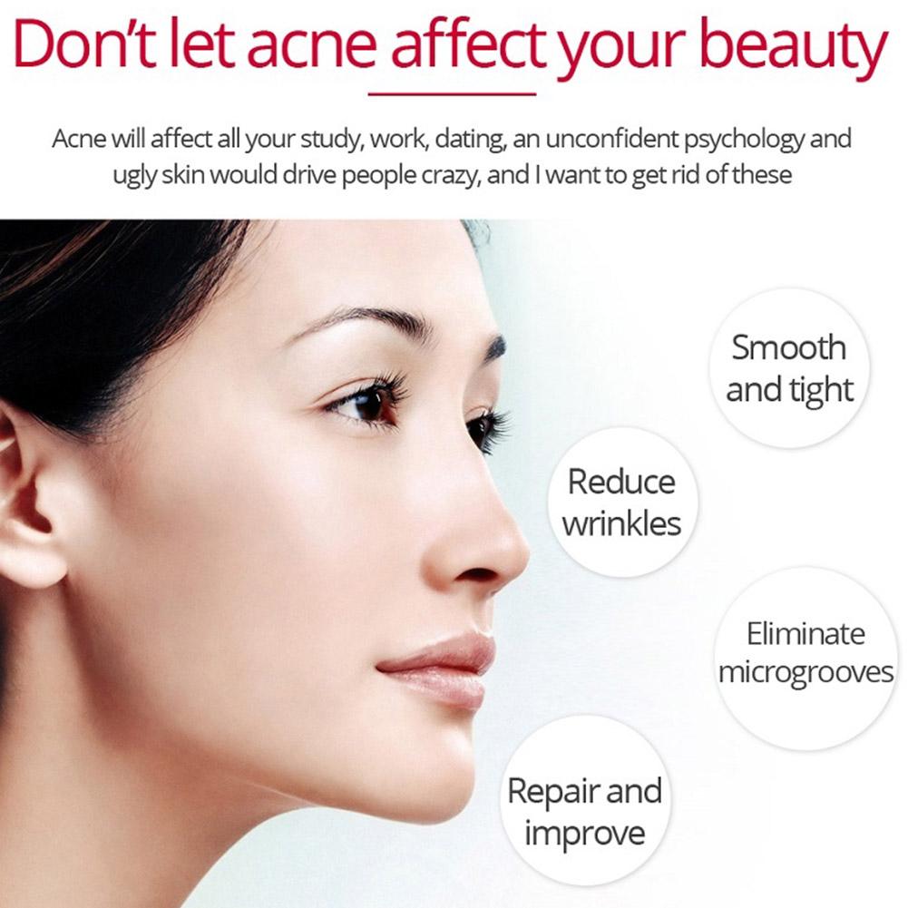 Retinol Lifting krem ujędrniaj – Retinol Anti Wrinkle Cream recenzja i cena